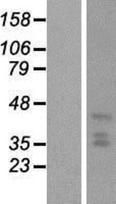 Western Blot: HDC2/PHC2 Overexpression Lysate [NBP2-10592]