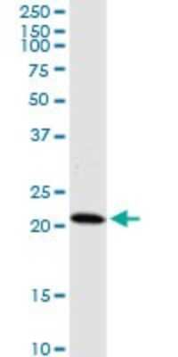 Western Blot: HDDC3 Antibody (7E6) [H00374659-M05]