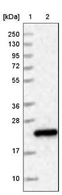 Western Blot: HDDC3 Antibody [NBP1-82684]