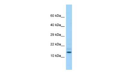 Western Blot: HDDC3 Antibody [NBP2-87556]