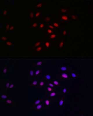 Immunocytochemistry/ Immunofluorescence: HDGF Antibody (5U7A7) [NBP3-15281]