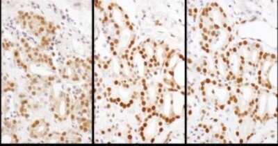 Immunohistochemistry: HDGF Antibody [NBP1-71925]