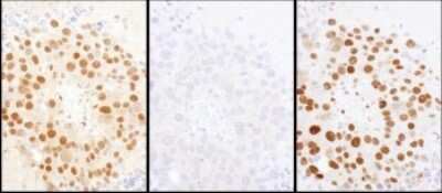 Immunohistochemistry: HDGF Antibody [NBP1-71925]