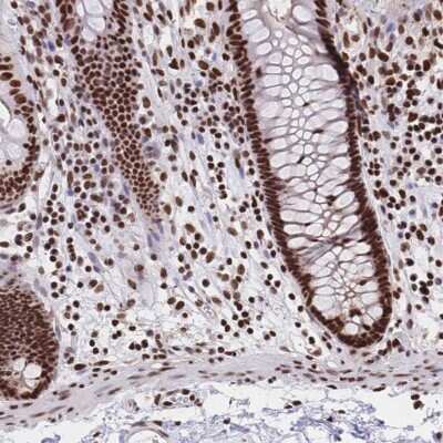 Immunohistochemistry: HDGF Antibody [NBP2-38701]