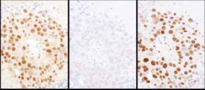 Immunohistochemistry-Paraffin: HDGF Antibody [NBP1-71924]