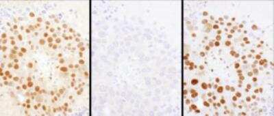Immunohistochemistry-Paraffin: HDGF Antibody [NBP1-71926]