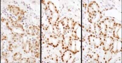 Immunohistochemistry-Paraffin: HDGF Antibody [NBP1-71926]