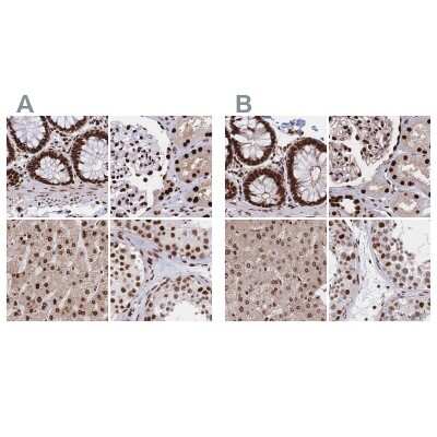 Immunohistochemistry-Paraffin: HDGF Antibody [NBP2-38589]