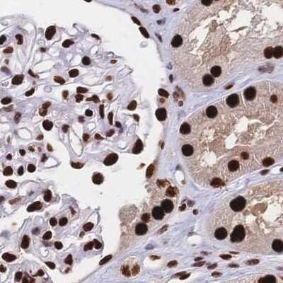 Immunohistochemistry-Paraffin: HDGF Antibody [NBP2-38589]