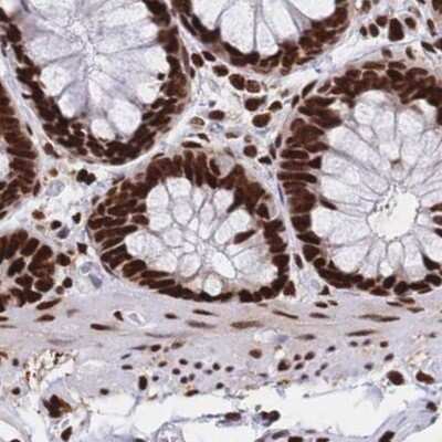 Immunohistochemistry-Paraffin: HDGF Antibody [NBP2-38589]