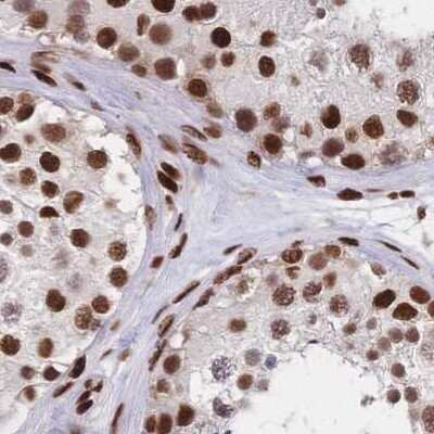 Immunohistochemistry-Paraffin: HDGF Antibody [NBP2-38589]