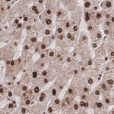 Immunohistochemistry-Paraffin: HDGF Antibody [NBP2-38589]