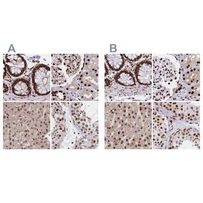 Immunohistochemistry-Paraffin: HDGF Antibody [NBP2-38701]
