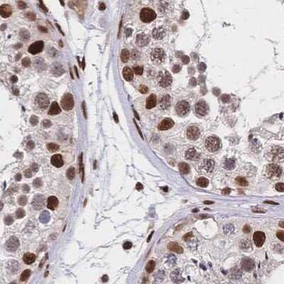 Immunohistochemistry-Paraffin: HDGF Antibody [NBP2-38701]