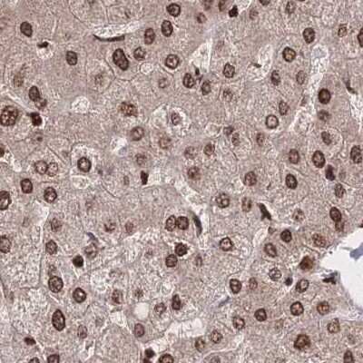 Immunohistochemistry-Paraffin: HDGF Antibody [NBP2-38701]