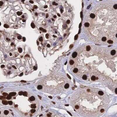 Immunohistochemistry-Paraffin: HDGF Antibody [NBP2-38701]