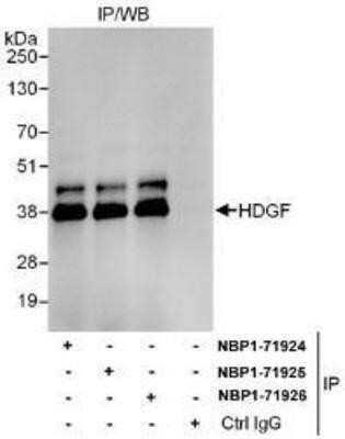 Immunoprecipitation: HDGF Antibody [NBP1-71924]