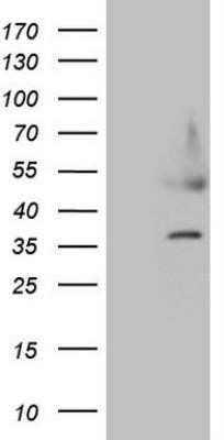 Western Blot: HDGF Antibody (OTI8C7)Azide and BSA Free [NBP2-70882]