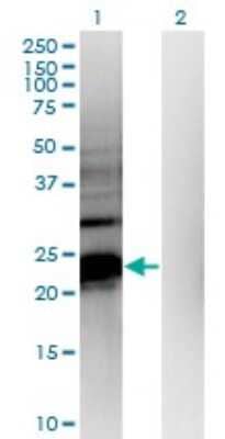 Western Blot: HDHD1A Antibody (4F12) [H00008226-M05]