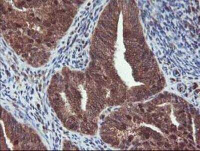 Immunohistochemistry-Paraffin: HDHD1A Antibody (OTI7A2) [NBP2-00487]