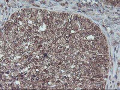 Immunohistochemistry-Paraffin: HDHD1A Antibody (OTI7A2) [NBP2-00487]