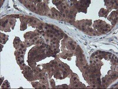Immunohistochemistry-Paraffin: HDHD1A Antibody (OTI7A2) [NBP2-00487]
