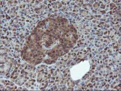 Immunohistochemistry-Paraffin: HDHD1A Antibody (OTI7A2) [NBP2-00487]