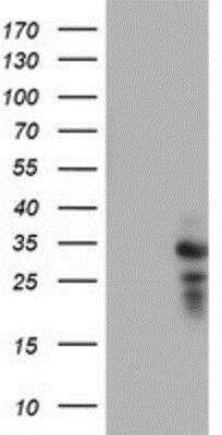 Western Blot: HDHD1A Antibody (OTI7A2) [NBP2-00487]