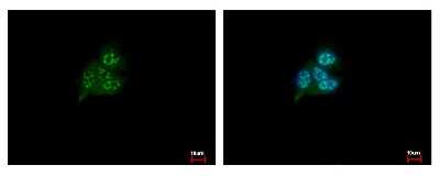 Immunocytochemistry/ Immunofluorescence: HDHD1A Antibody [NBP2-14971]