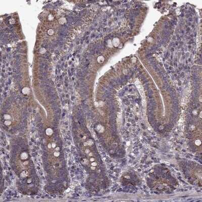 Immunohistochemistry: HDHD1A Antibody [NBP2-68942]