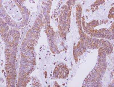 Immunohistochemistry-Paraffin: HDHD1A Antibody [NBP2-14971]