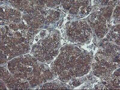 Immunohistochemistry: HDHD1A Antibody (OTI7A2) - Azide and BSA Free [NBP2-71368]