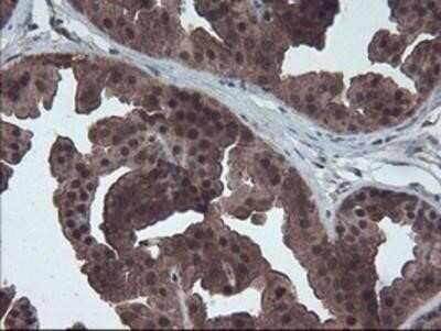 Immunohistochemistry: HDHD1A Antibody (OTI7A2) - Azide and BSA Free [NBP2-71368]