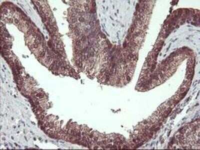 Immunohistochemistry: HDHD1A Antibody (OTI7A2) - Azide and BSA Free [NBP2-71368]