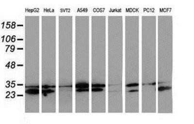 Western Blot: HDHD1A Antibody (OTI7A2)Azide and BSA Free [NBP2-71368]
