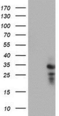 Western Blot: HDHD1A Antibody (OTI7A2)Azide and BSA Free [NBP2-71368]