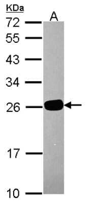 Western Blot: HDHD1A Antibody [NBP2-14971]