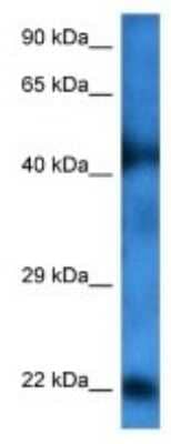 Western Blot: HDHD1A Antibody [NBP3-09989]