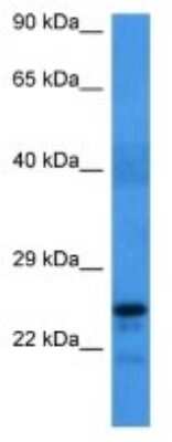 Western Blot: HDHD1A Antibody [NBP3-10024]