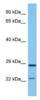 Western Blot: HDHD1A Antibody [NBP3-10058]