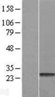 Western Blot: HDHD1A Overexpression Lysate [NBL1-11491]