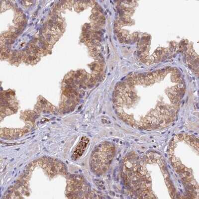 Immunohistochemistry: HDHD2 Antibody [NBP2-31987]