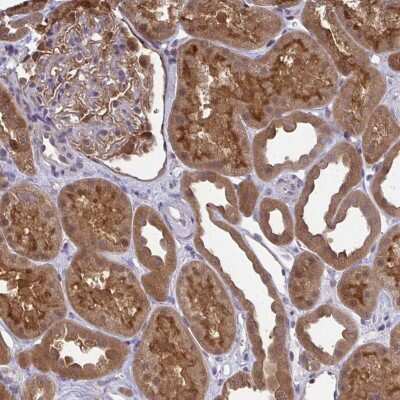 Immunohistochemistry-Paraffin: HDHD2 Antibody [NBP2-31799]