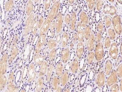 Immunohistochemistry-Paraffin: HDHD2 Antibody [NBP2-99209]