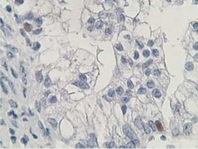 Immunohistochemistry: HDHD2 Antibody (OTI4G3) - Azide and BSA Free [NBP2-72259]