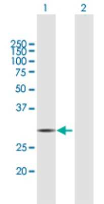 Western Blot: HDHD2 Antibody [H00084064-B01P]