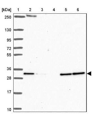 Western Blot: HDHD2 Antibody [NBP2-31799]