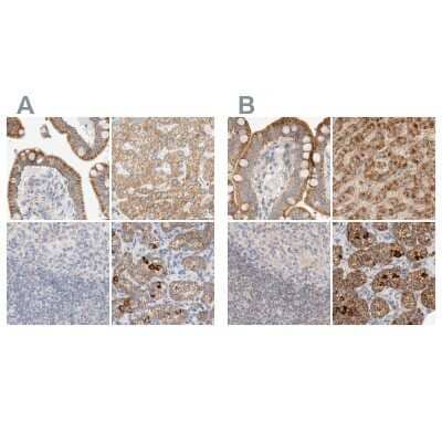 Immunohistochemistry-Paraffin: HDHD3 Antibody [NBP1-86707]