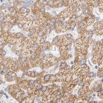Immunohistochemistry-Paraffin: HDHD3 Antibody [NBP1-86707]