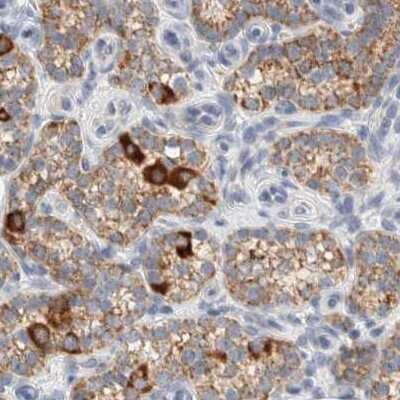 Immunohistochemistry-Paraffin: HDHD3 Antibody [NBP1-86707]